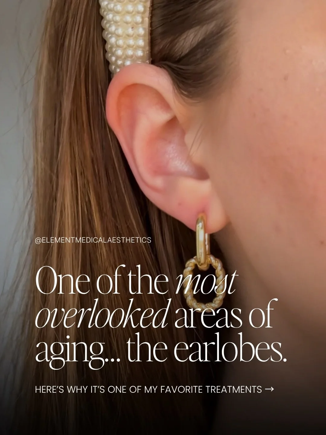 Help support those lobes with a little bit of filler! 

It&rsquo;s so quick &amp; virtually painless! 

📍 McKinney, TX 
☎️ call/text (972)275-6167
📲 link in bio to book