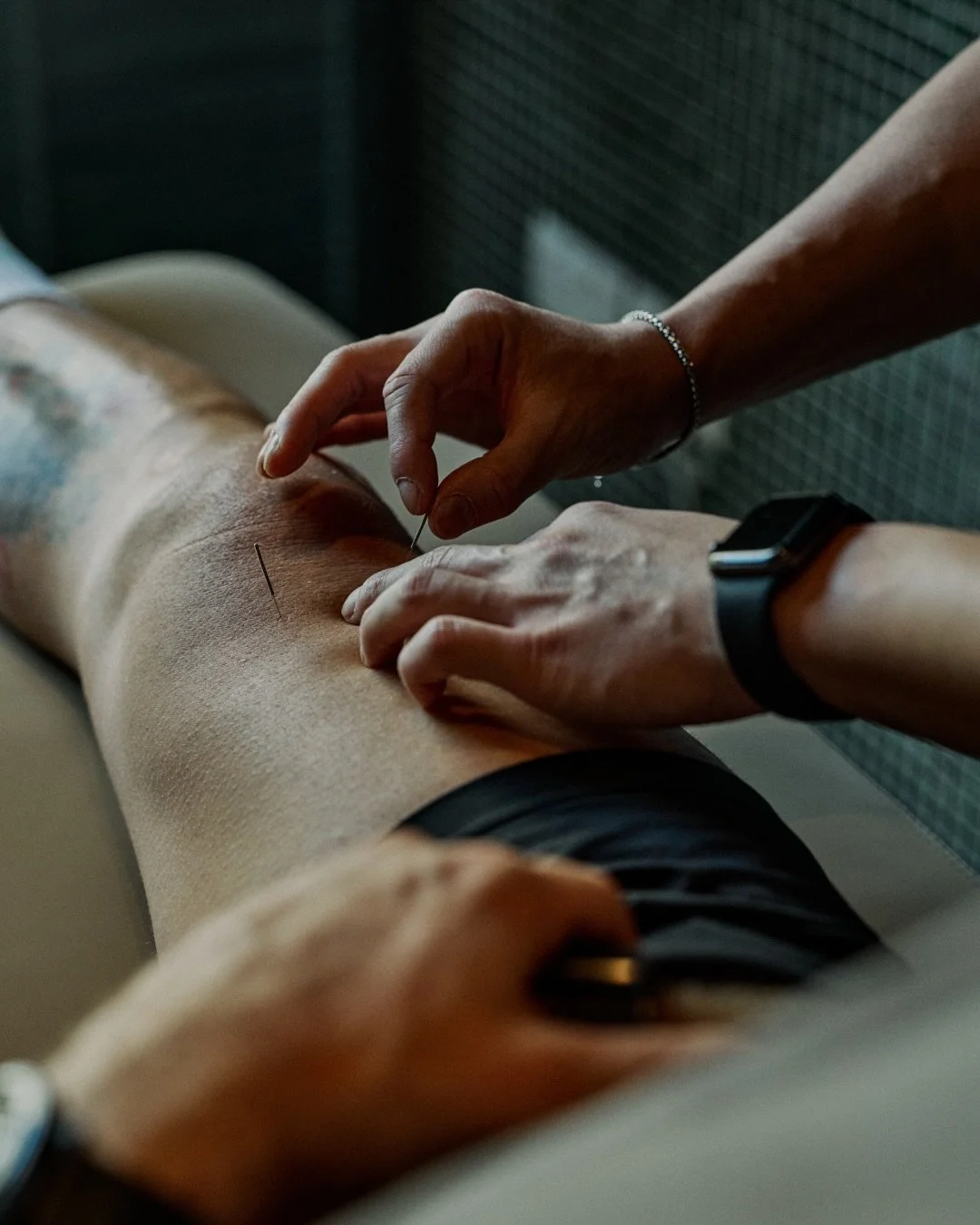 Recovery is part of the process.

When your body is constantly training, working and moving through stress, tension starts to build up in ways you don&rsquo;t always notice immediately.

That&rsquo;s where recovery work comes in.

Treatments like acu