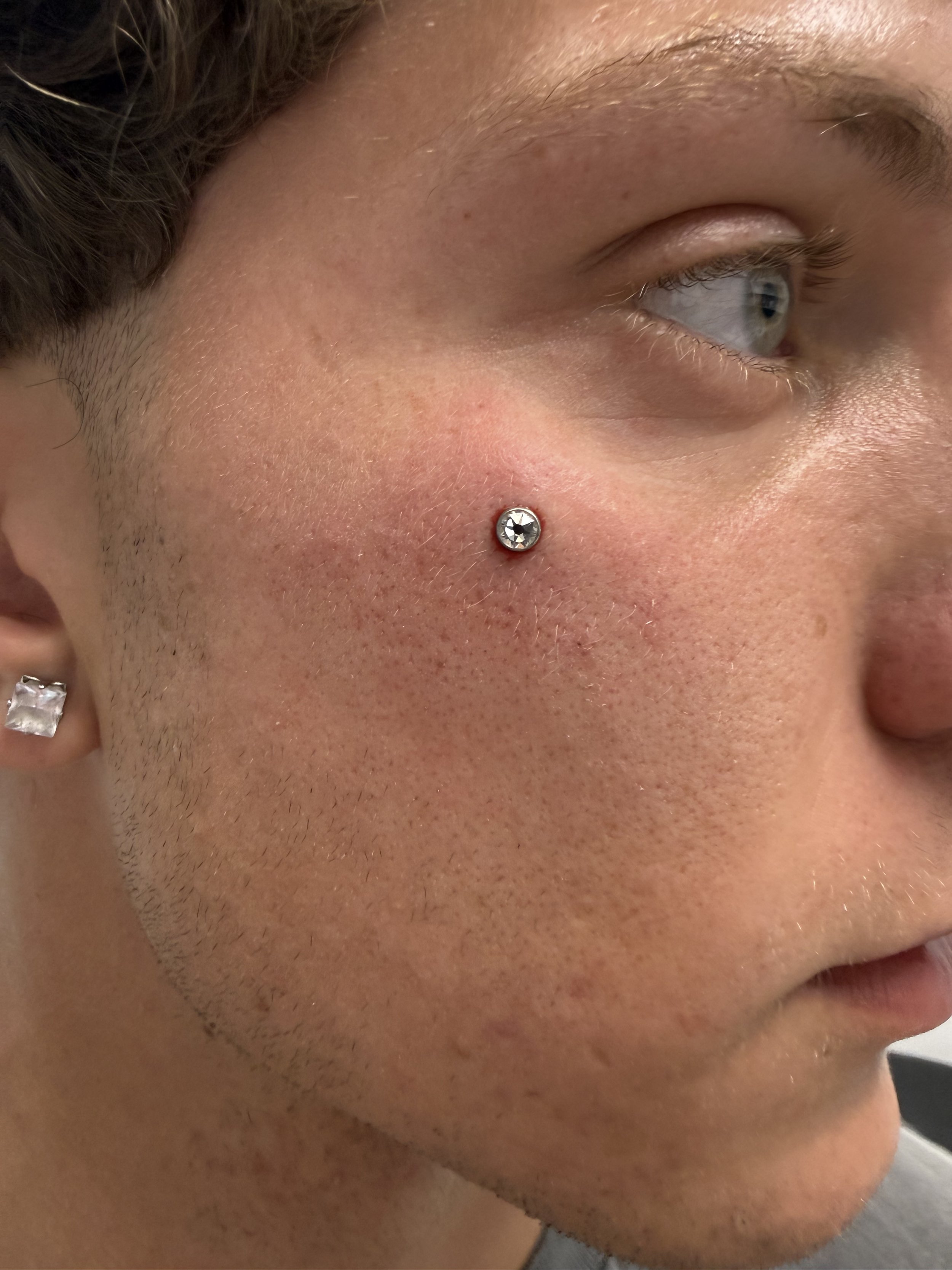 body-piercing-fremantle-body-piercing-fremantle-face-dermal-perth-face-dermal-fremantle.JPG
