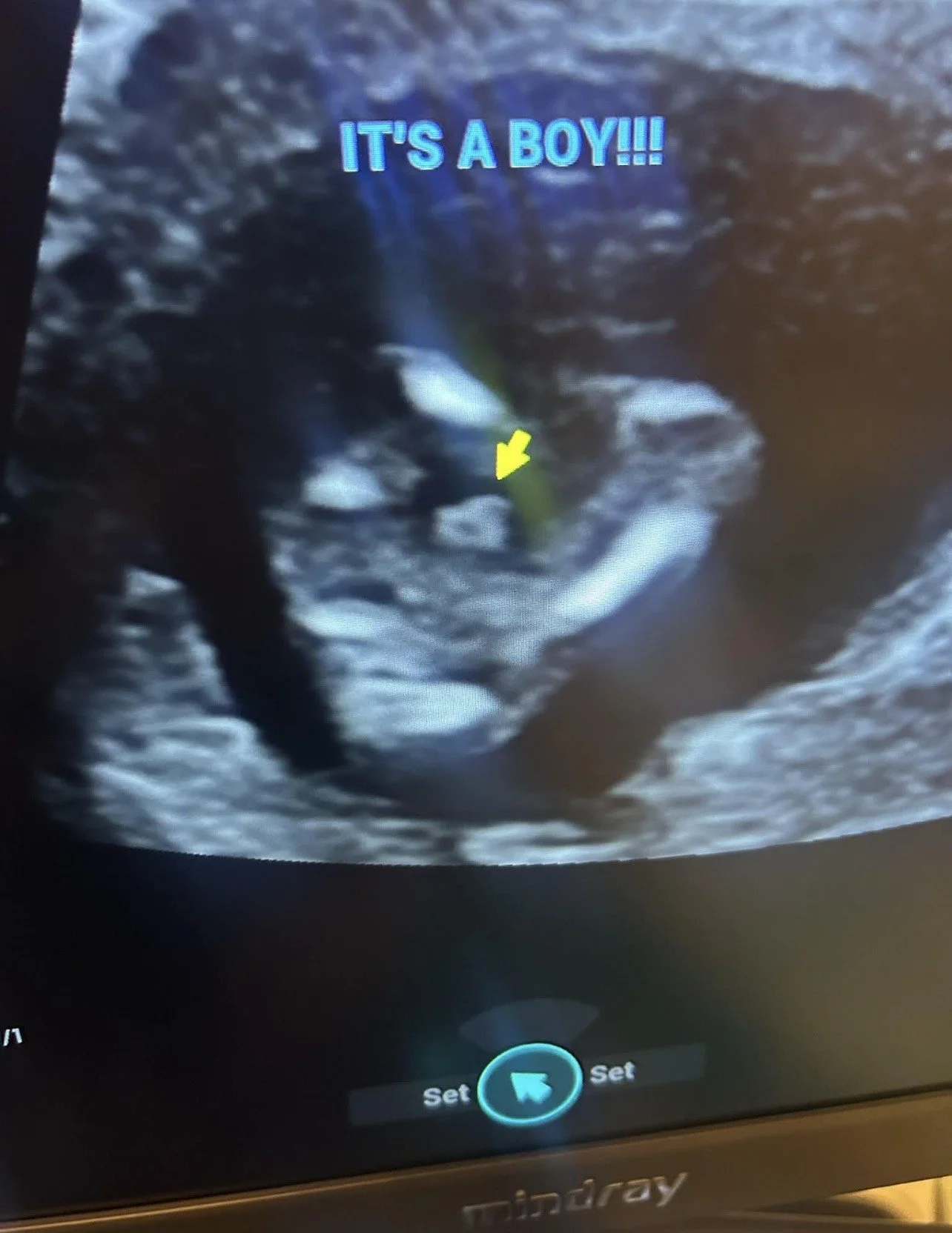Gender reveal-boy.jpg