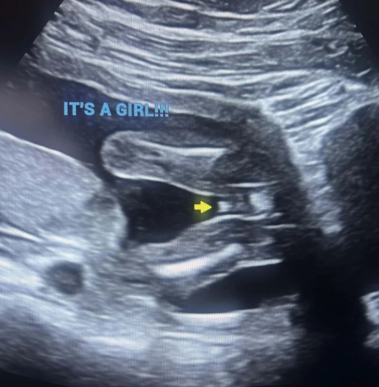 Gender reveal-girl.jpg
