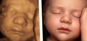 Real View 8k Imaging