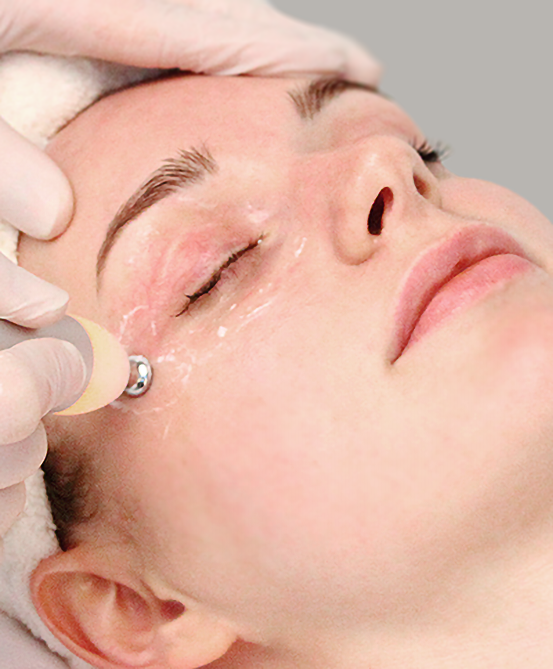 Salt Microdermabrasion Facial