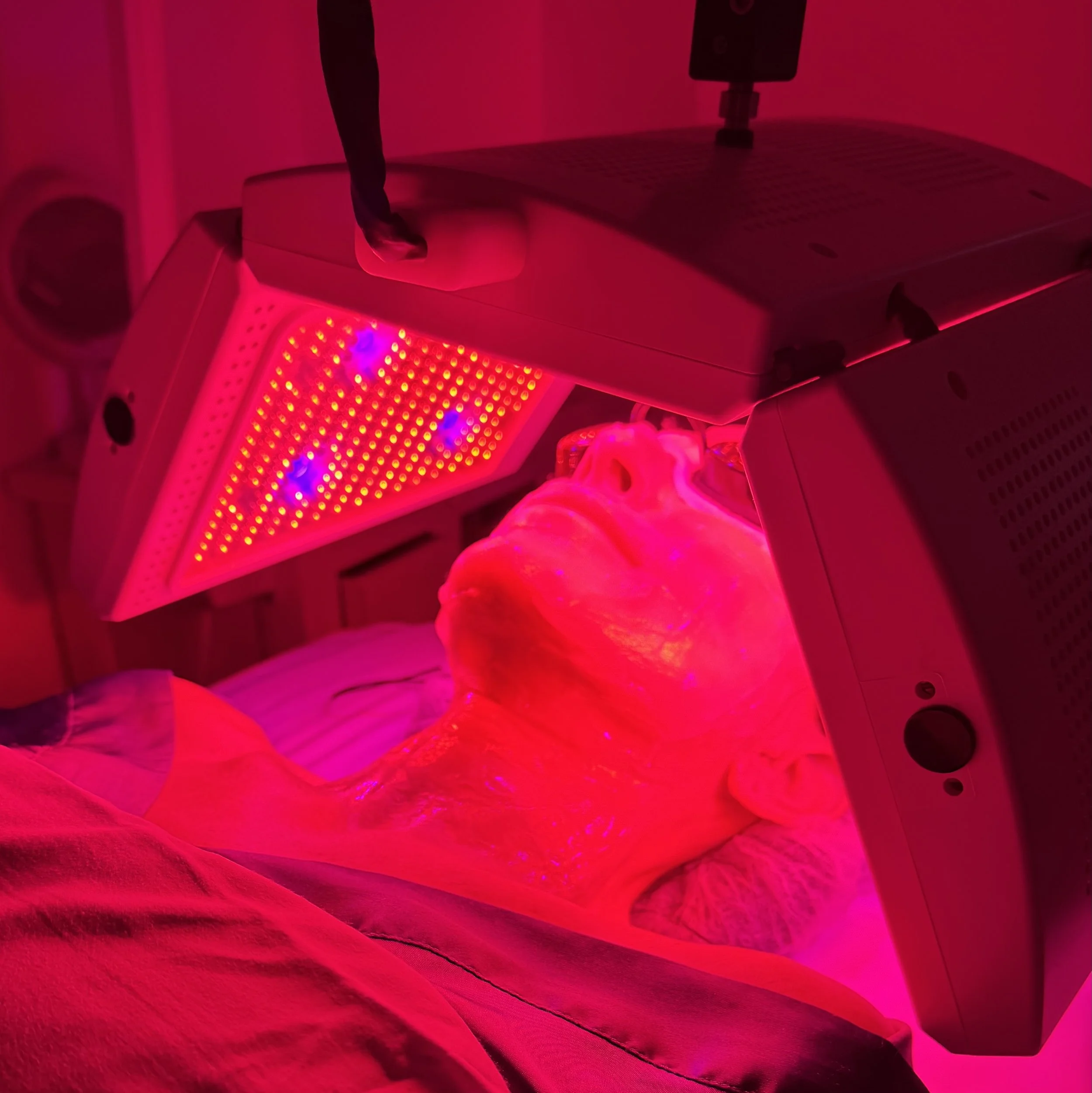 Macro Rejuvenation Facial