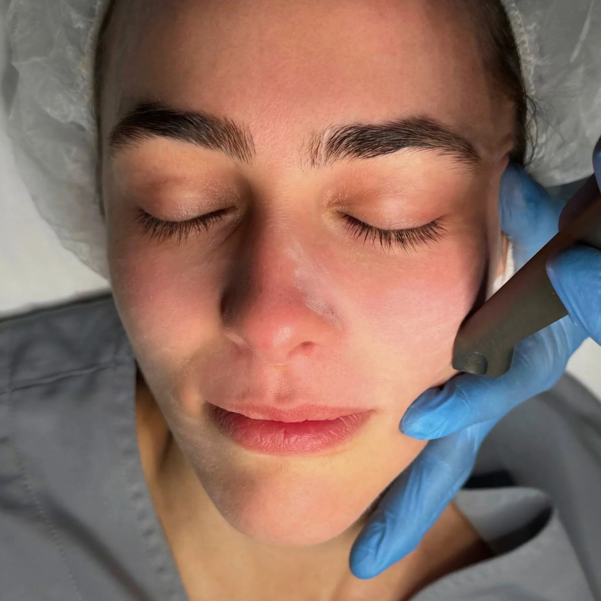 Organic Salt Microdermabrasion Treatment