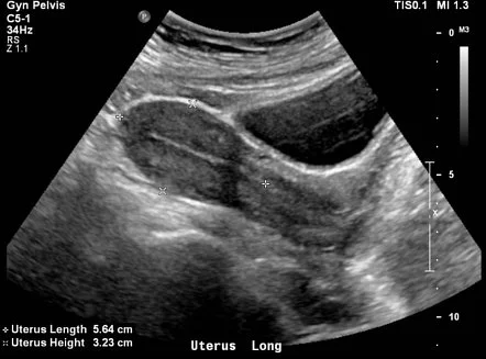 Female Uterus