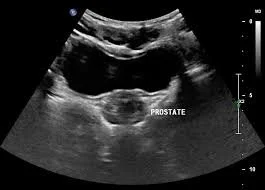 Male Prostate