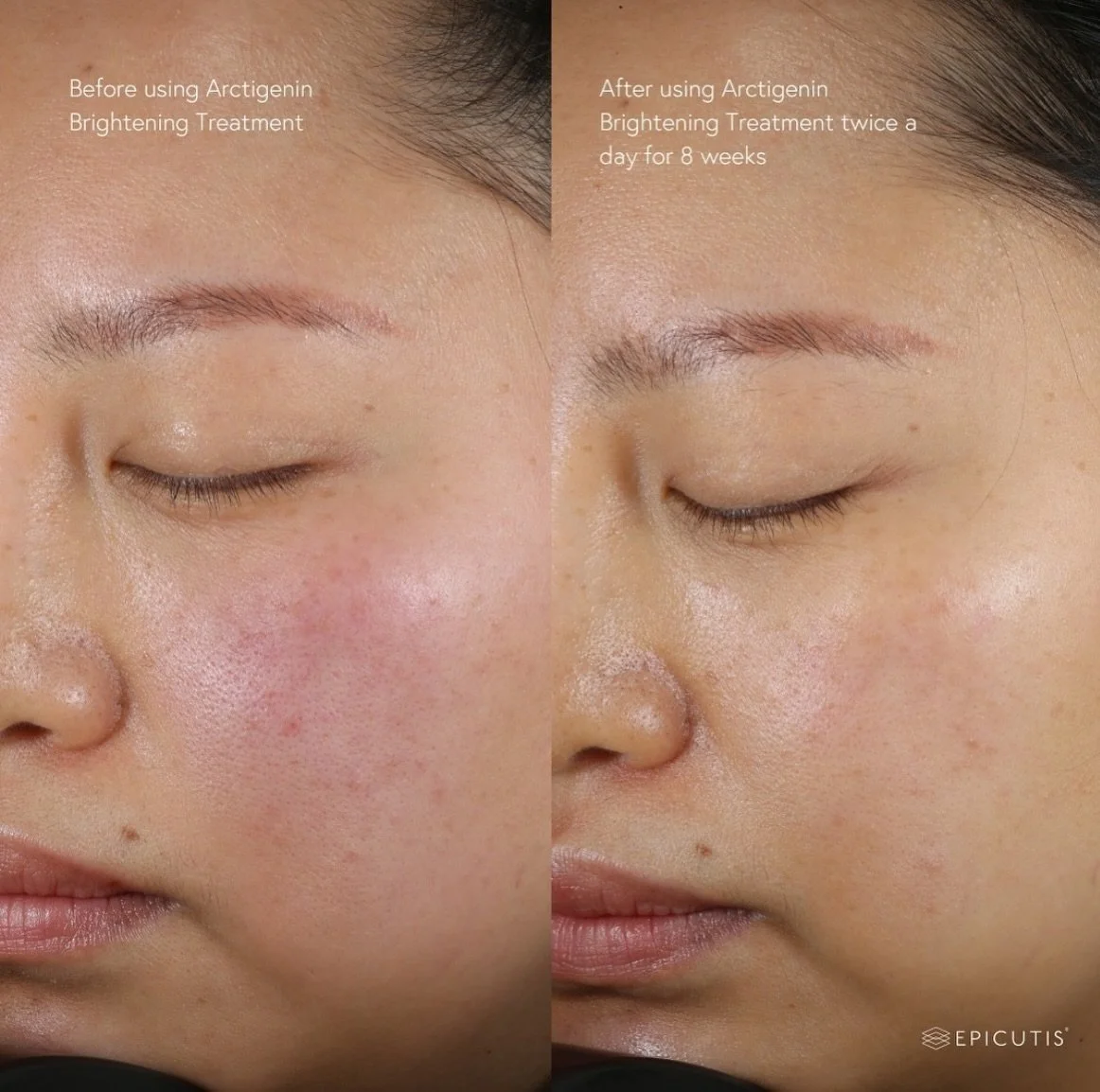A staple for everyone&rsquo;s skin routine, especially here in Southern California.

This luxurious cream is both light weight and nourishing, acting as not only a brightening serum but also as a moisturizer.

If you struggle with PIE (post inflammat
