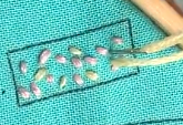 Seed Stitch