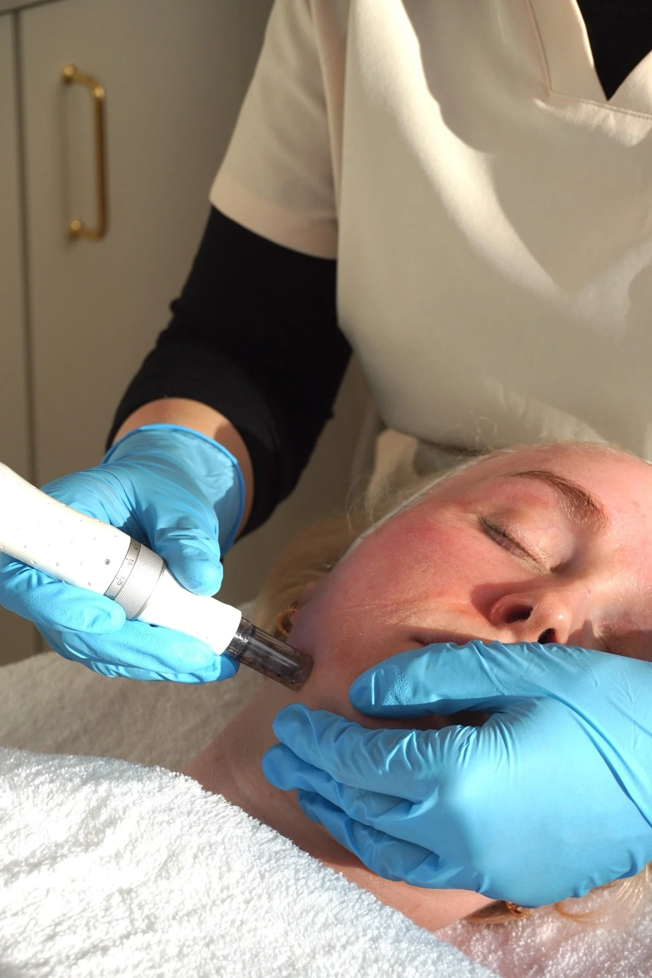 A person is receiving a facial treatment with a suction device applied to their face, lying on a treatment bed with a white towel. The practitioner wears blue gloves and a white coat, in a clinical setting.