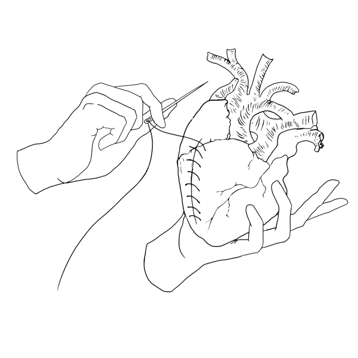 Line drawing of a medical procedure on a human heart, with hands holding surgical tools.