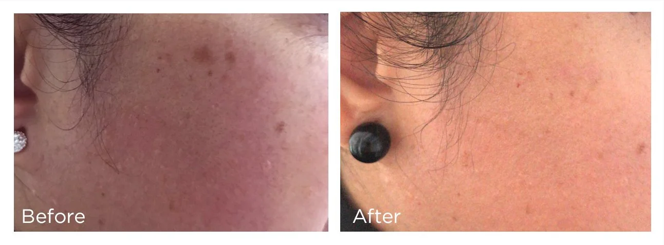 FreezePen - 2 - Print.jpg