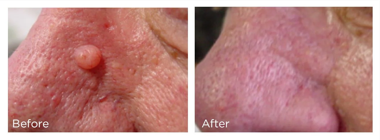 FreezePen - 10 - Print.jpg