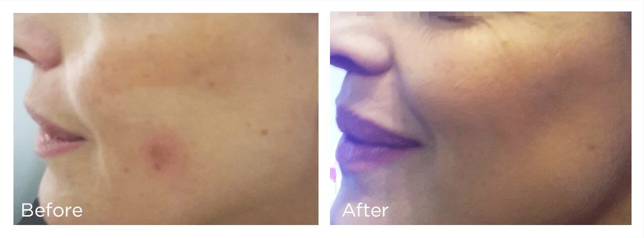 FreezePen - 3 - Print.jpg