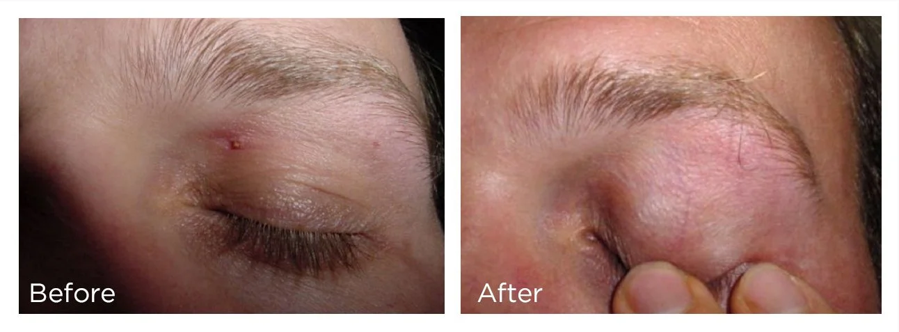 FreezePen - 4 - Print.jpg