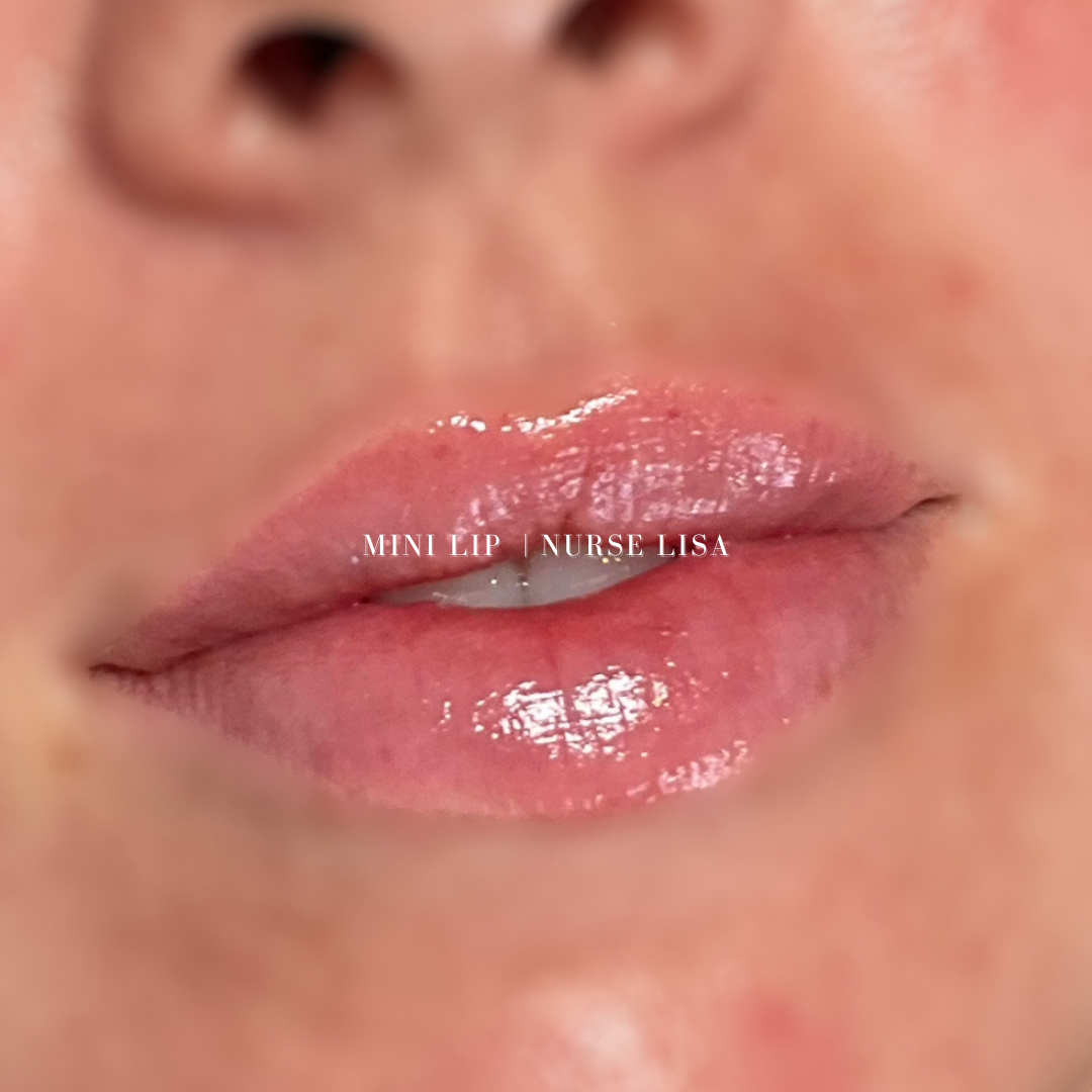 BOTOX FILLERS-59.png