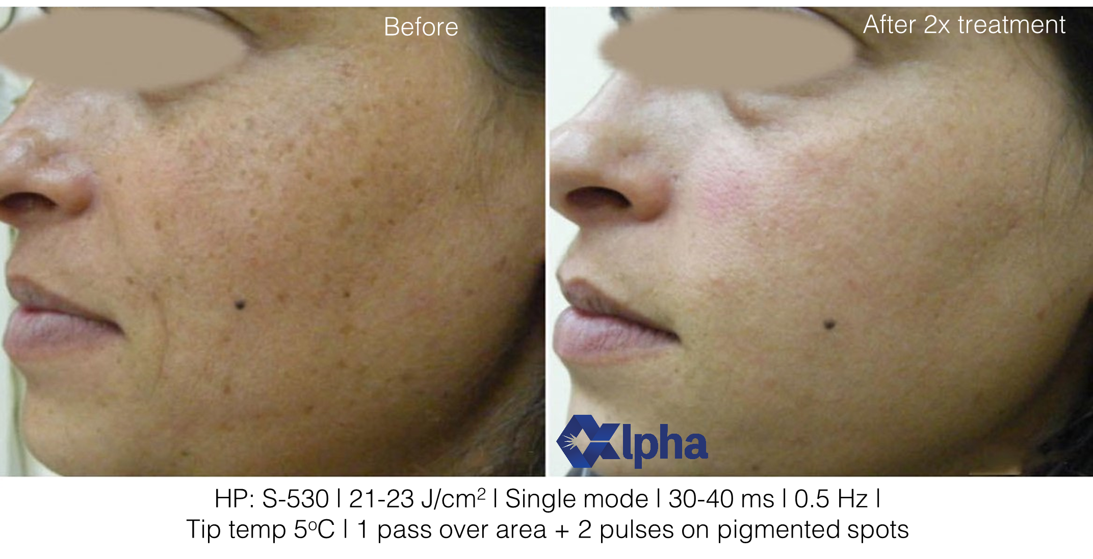 3D IPL B&A_13 sun spot.png