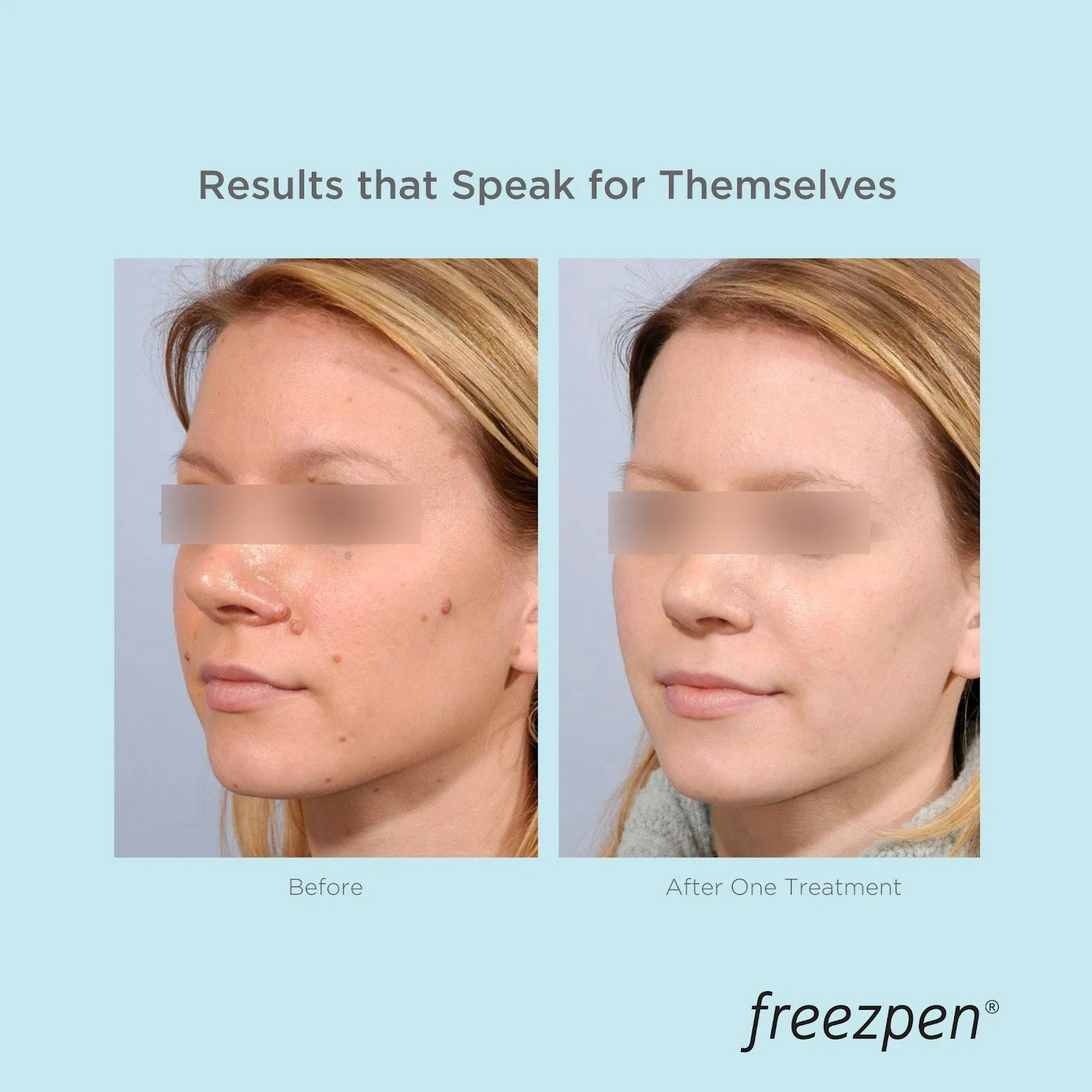 Freezpen - Social Media Posts-01.jpg