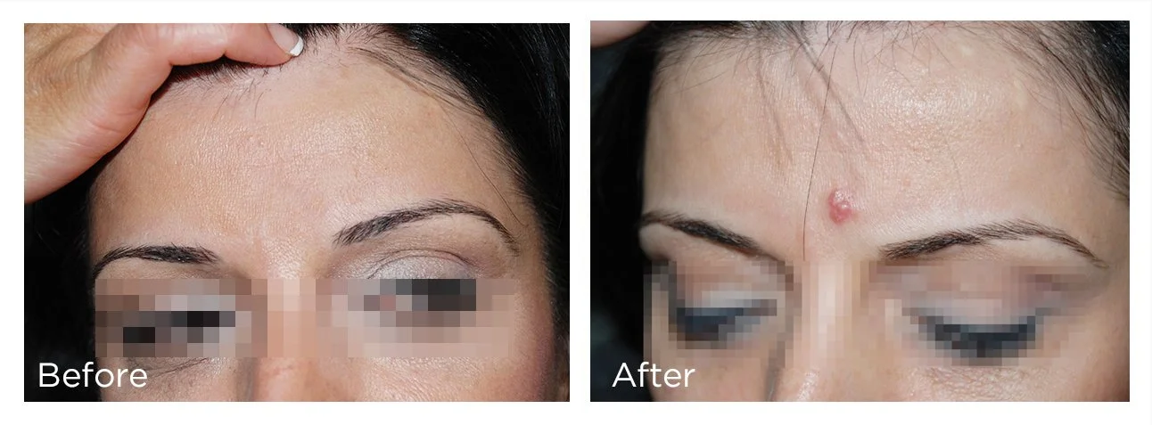 FreezePen - 5 - Print.jpg