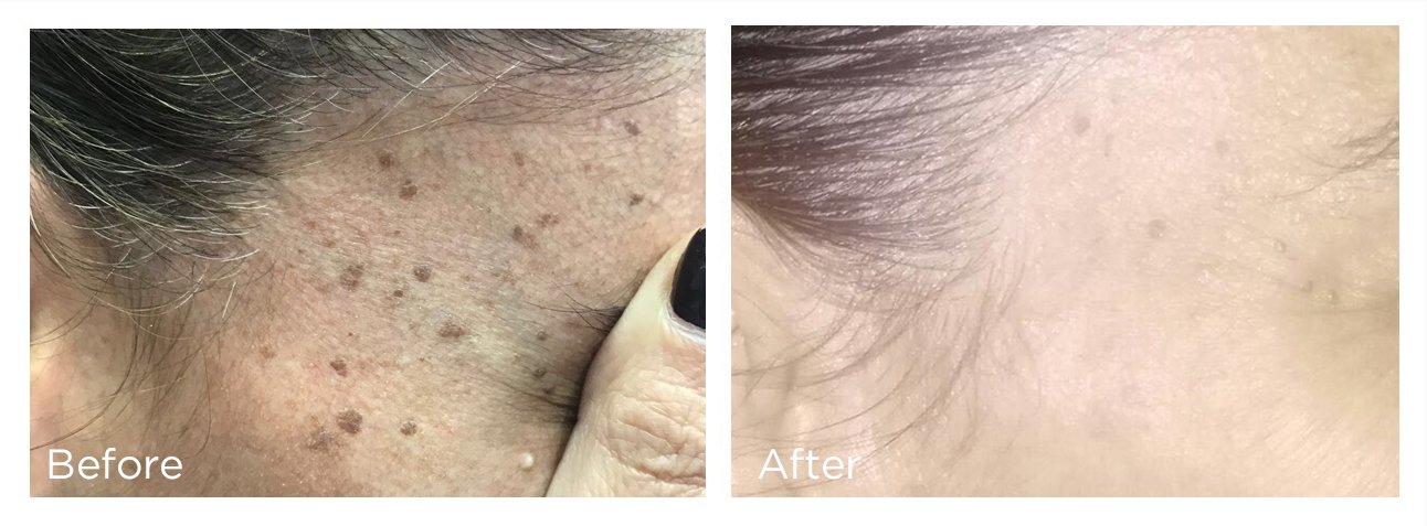 FreezePen - 9 - Print.jpg