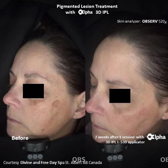 3D IPL B&A_28.a.jpg