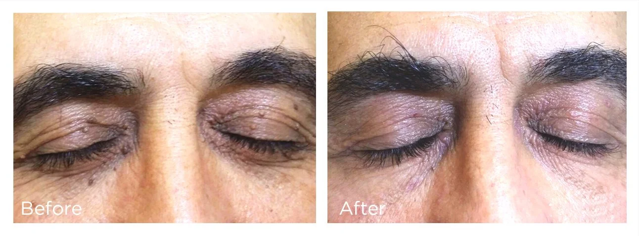 FreezePen - 8 - Print.jpg