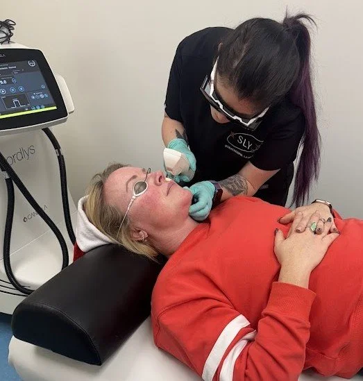 IPL therapy for rosacea uses targeted light energy to reduce redness, visible blood vessels, and inflammation. The treatment works by collapsing dilated capillaries beneath the skin, helping to calm flare-ups and restore a more even complexion.