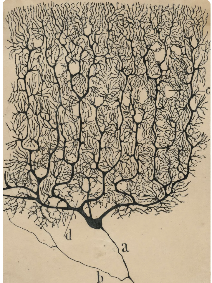 Illustration of the human brain's vascular system, showing numerous branching blood vessels.