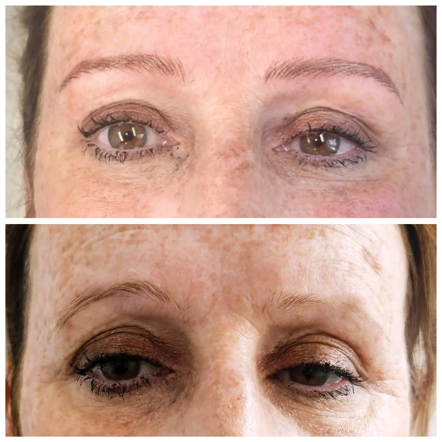 Transformation in Progress!🤩

This beauty came to me feeling frustrated with uneven brows &mdash; one noticeably lower and with less hair. She was tired of relying on brow pencil every day, only to end up with results she didn&rsquo;t love.

After j
