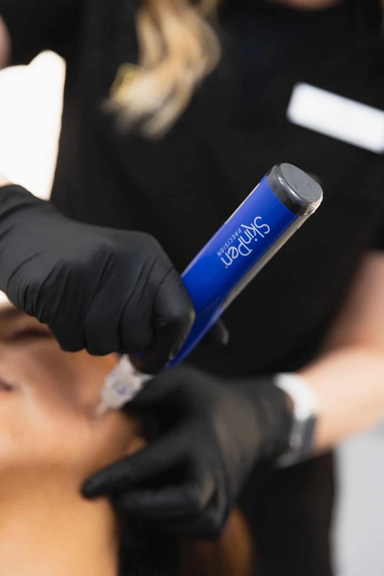Close-up of a medical professional in black gloves using a microneedling device on a person's cheek.