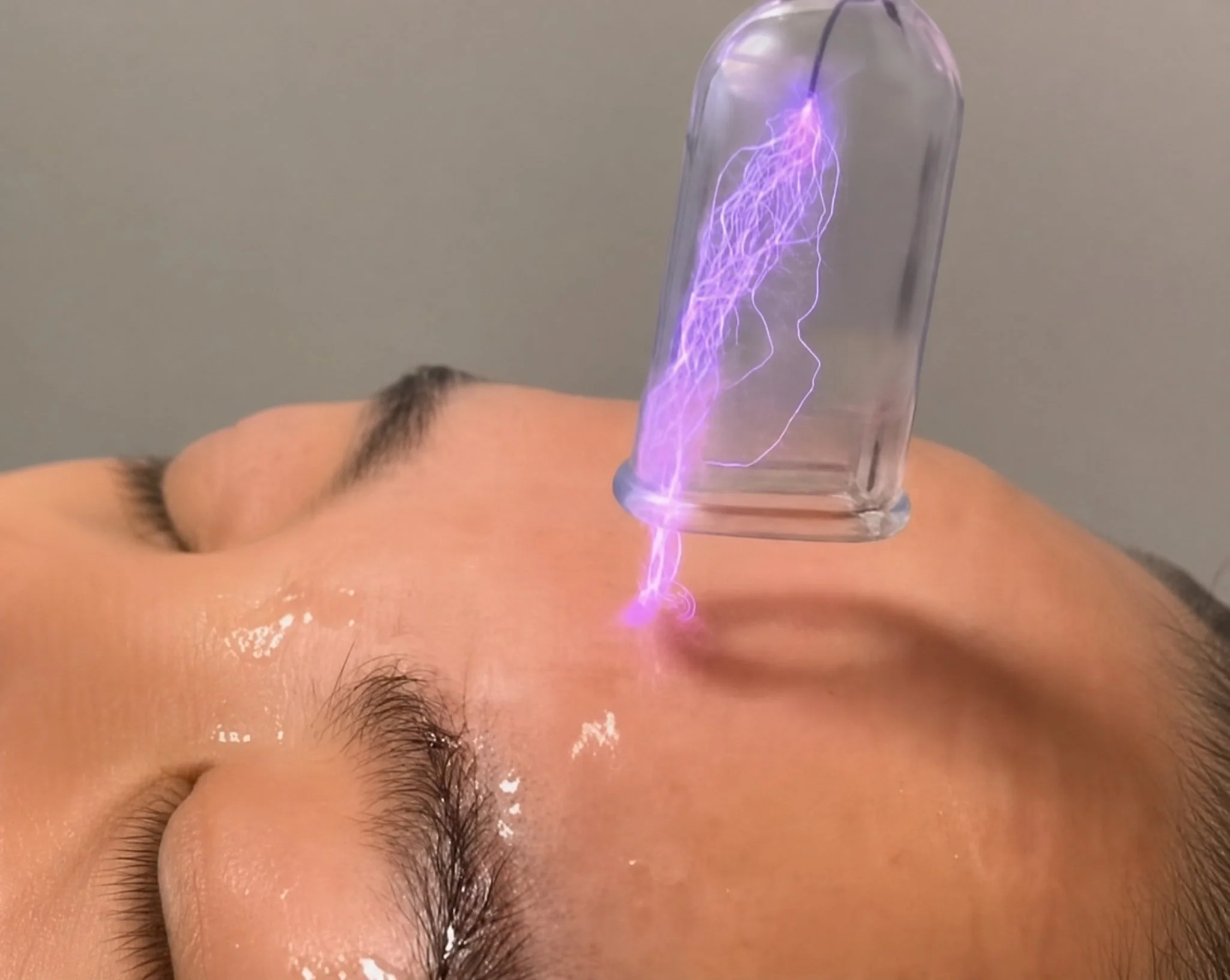 Hot and Cold Plasma Treatments