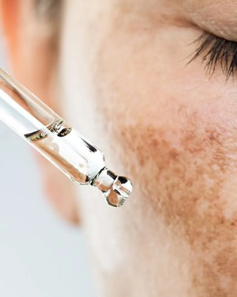 🌟 Say Goodbye to Melasma! 🌟

Hey, everyone! 🌼 Today, let&rsquo;s talk about melasma&mdash;those pesky brown patches that can appear on our skin, often due to hormonal changes or sun exposure. ☀️

✨ What is Melasma? Melasma is a common skin conditi