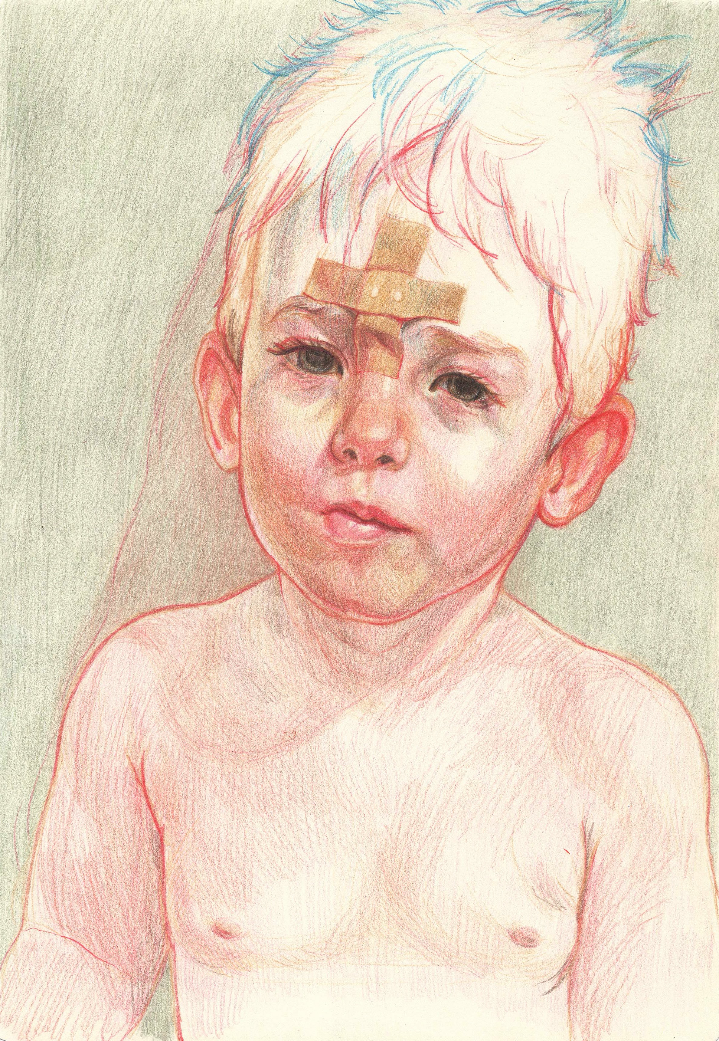 A colored pencil drawing of a young boy with bandages on his forehead, standing shirtless against a neutral background.