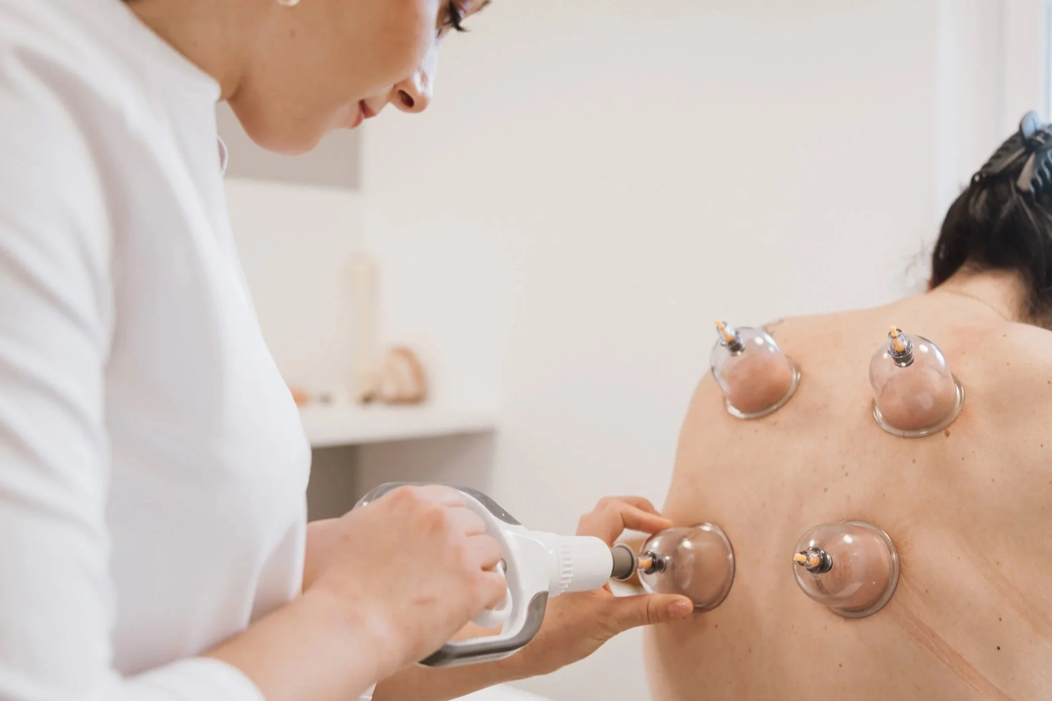 Frau führt eine physiotherapeutische Behandlung mit cupping-Massage an einem Rücken durch.
