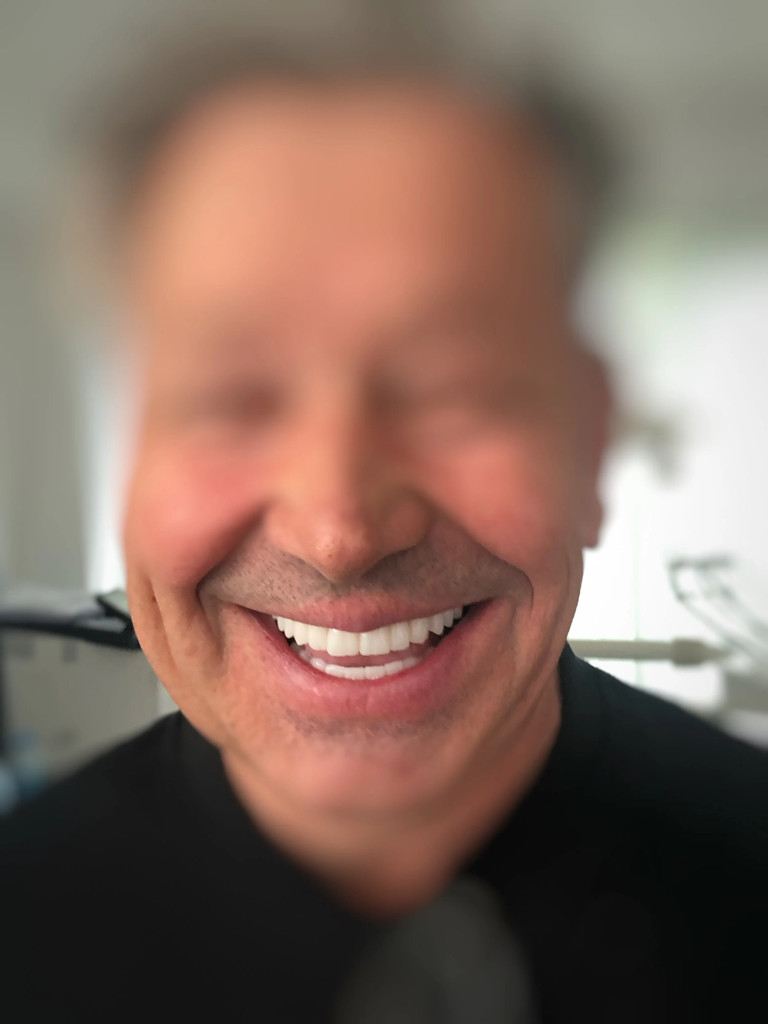 Efectele fricii de dentist: pierderea dinților, edentații și zâmbet afectat