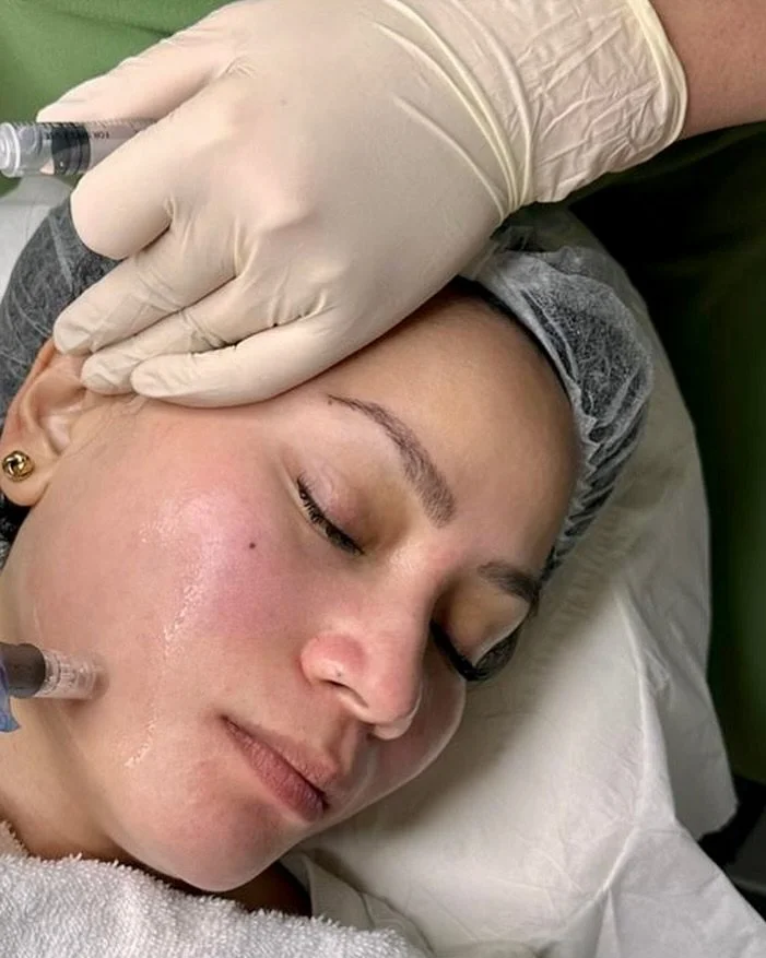 A woman lying on a hospital bed, receiving a cosmetic facial treatment with a syringe near her cheek, wearing a hair cap, with her eyes closed and a relaxed expression.