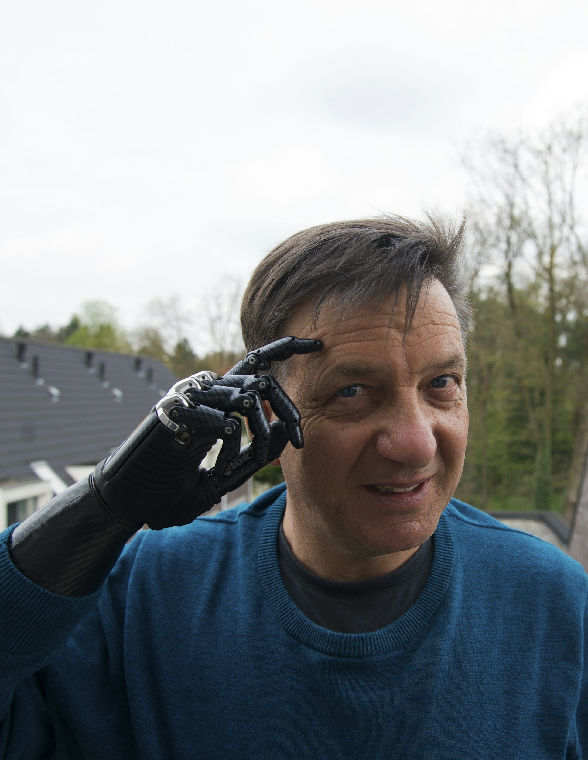 From Lab to Life: Journey of a Bionic Hand