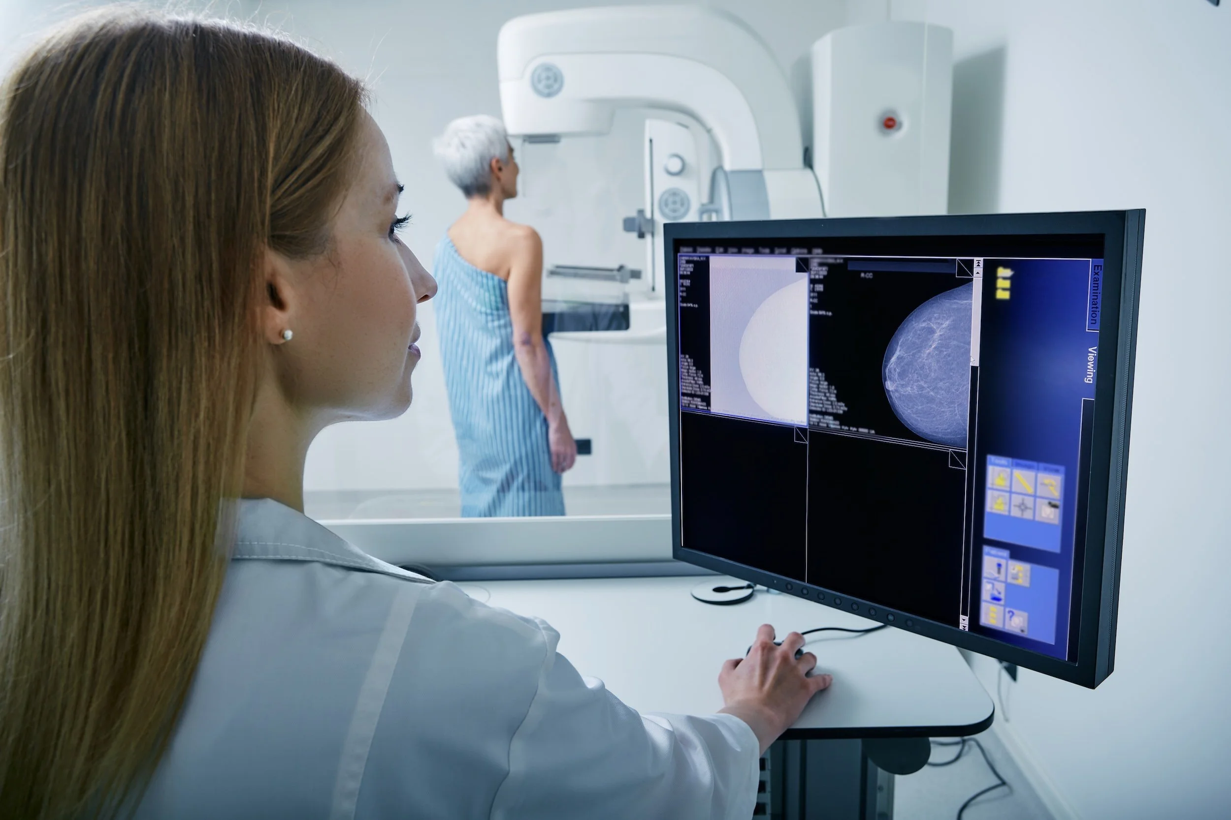 How 3D Mammography Is Changing the Future of Breast Cancer Detection