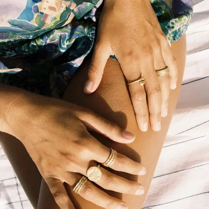 Close-up of a person’s hands with rings resting on a leg, wearing patterned clothing, seated on a striped surface.