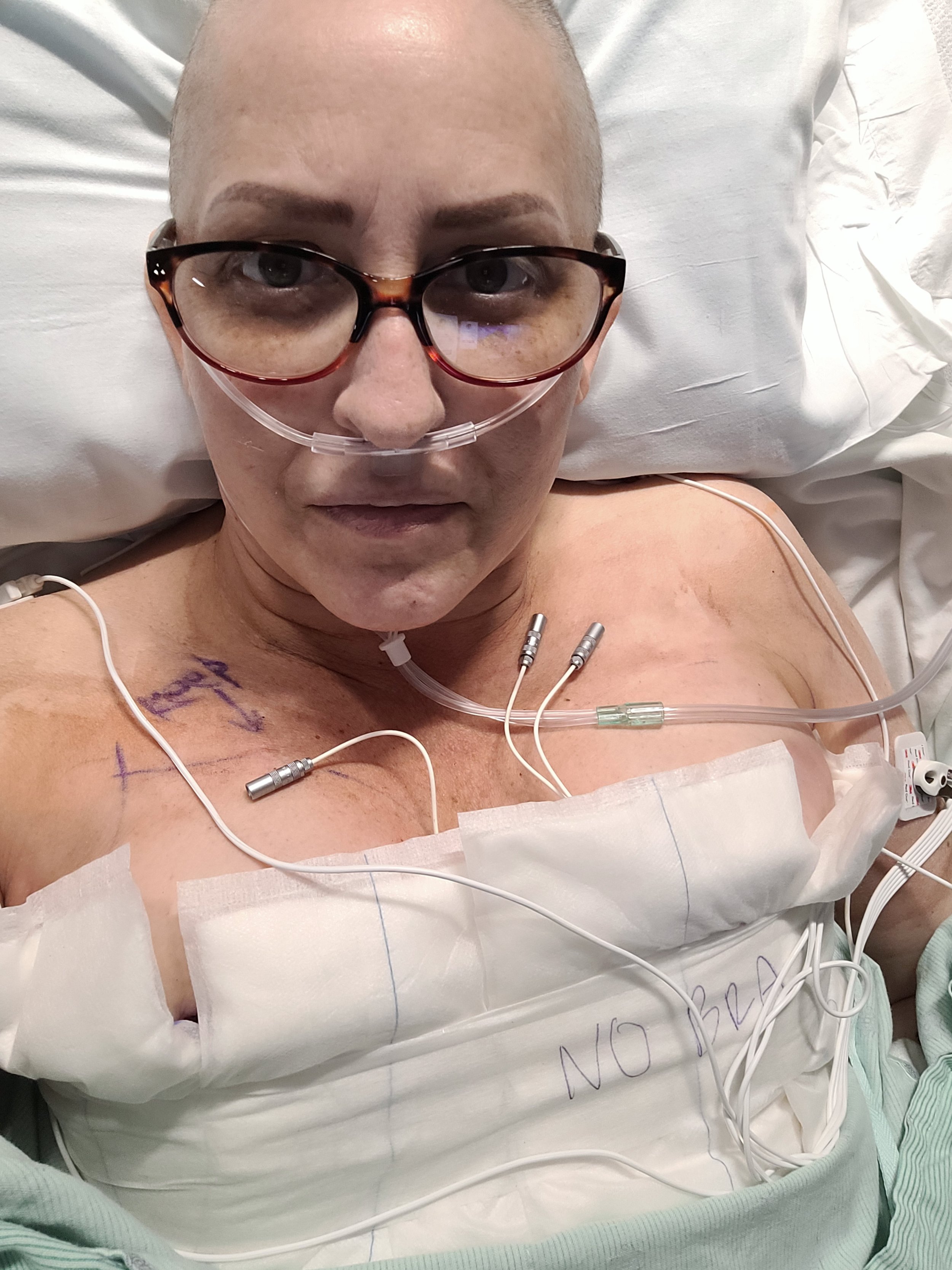 Dana lying in a hospital bed with medical tubes and wires attached, wearing glasses and a nasal oxygen tube after DIEP Flap surgery for breast reconstruction.