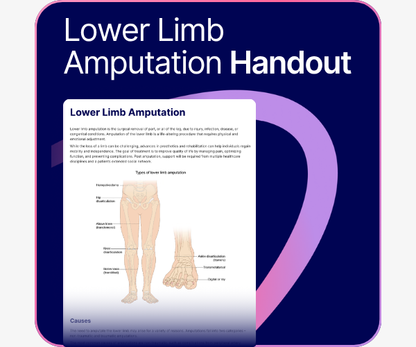 lower limb amputation handout