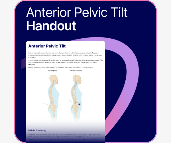 Anterior Pelvic Tilt handout.