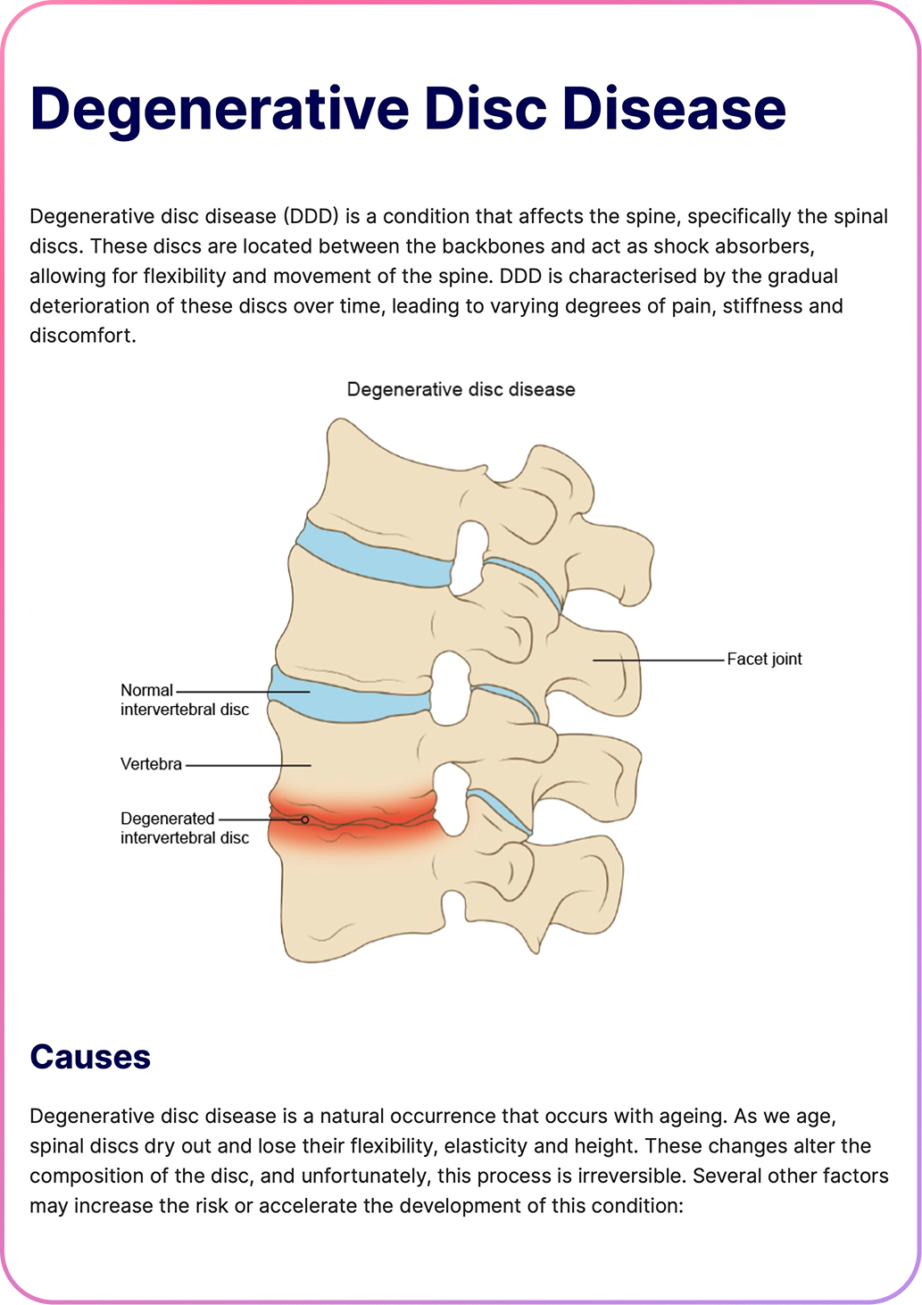 Cetra Health Degenerative Disc Disease Patient Handout