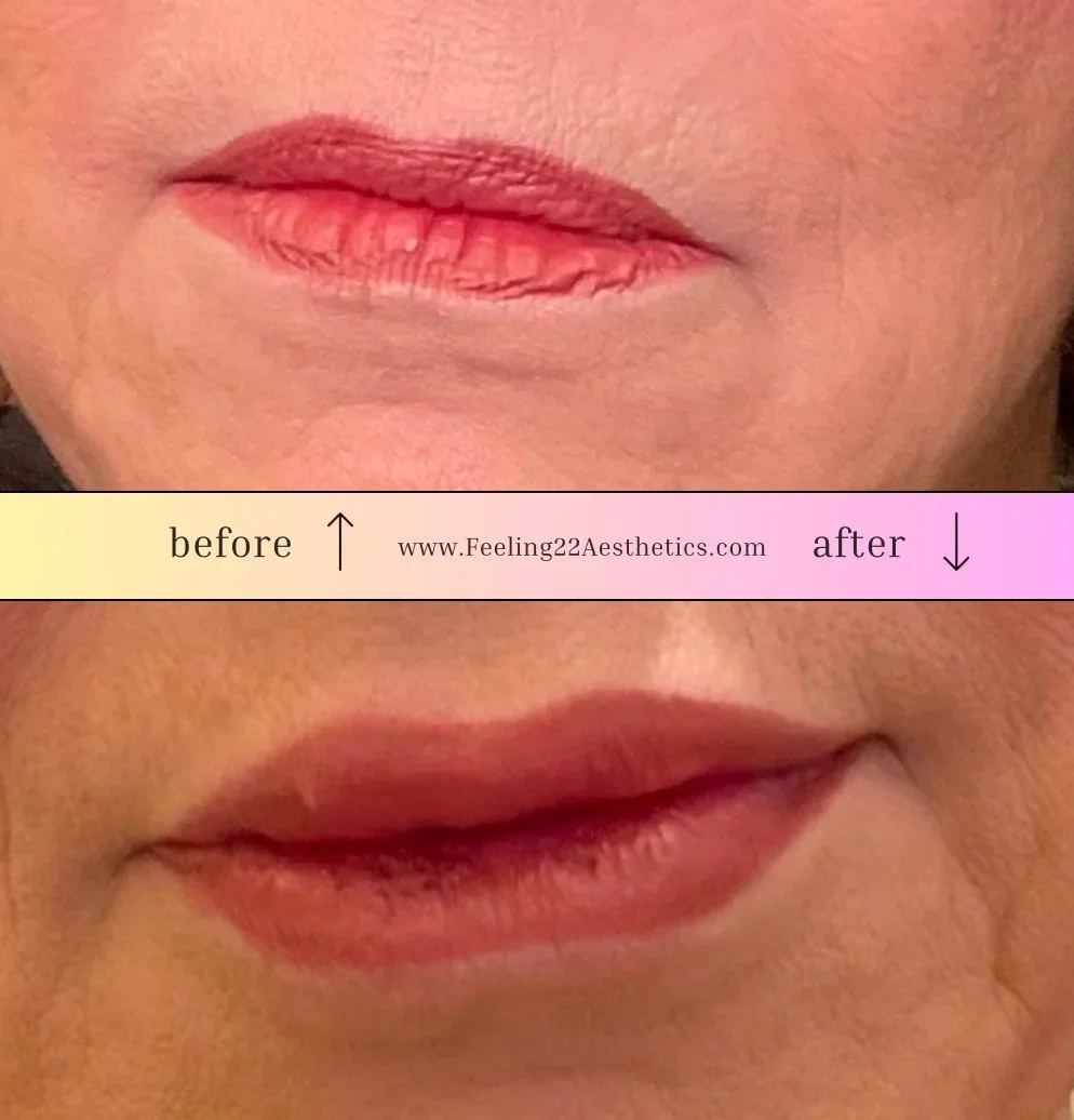Close-up of a person's lips showing a before and after comparison of lip enhancement or makeup application, with the top image labeled 'before' and the bottom labeled 'after'.