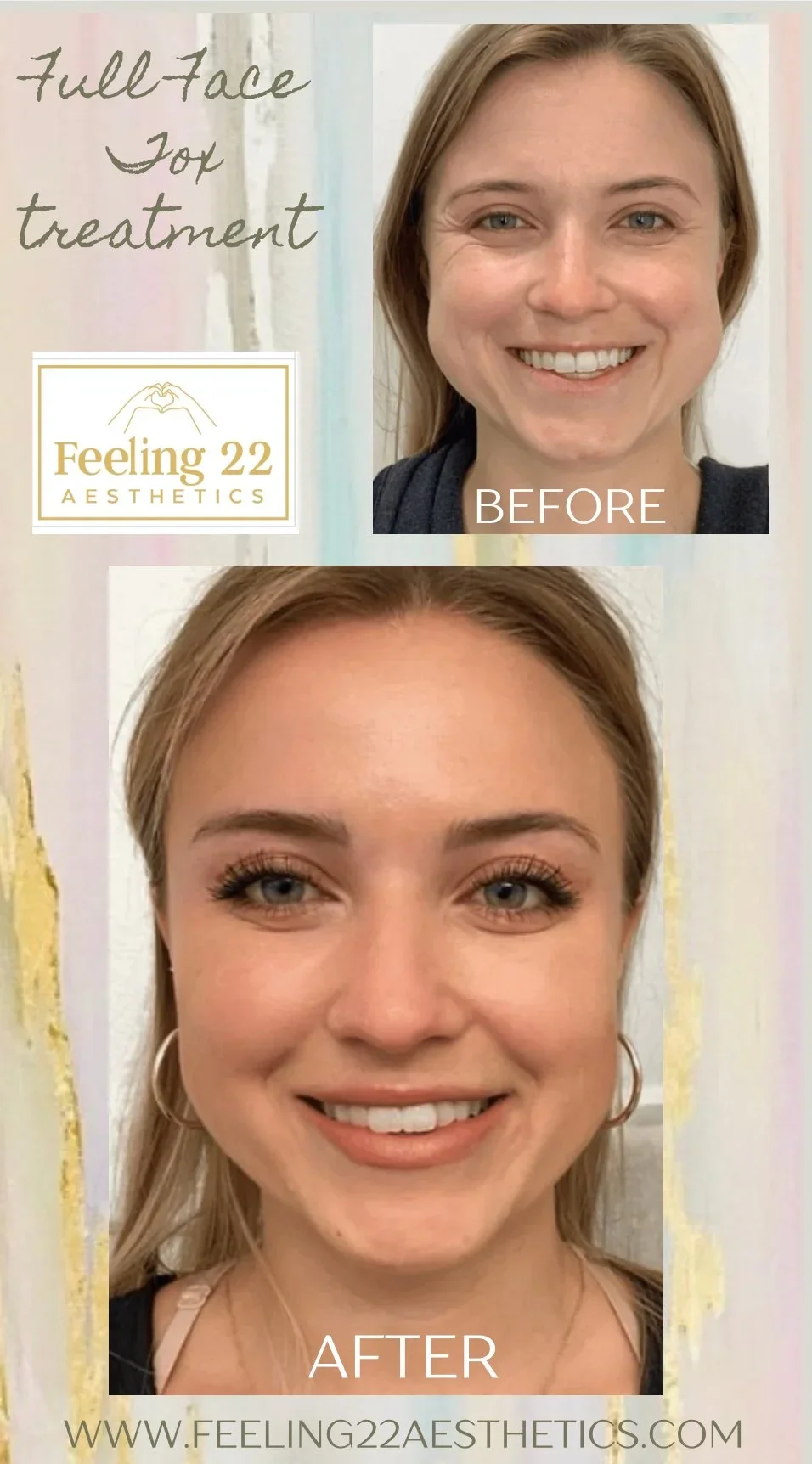 Comparison of a woman's face before and after full face fox treatment at Feeling 22 Aesthetics. The before image shows her with a natural look, and the after image shows her with makeup, lifted features, and enhanced eyelashes and eyebrows.