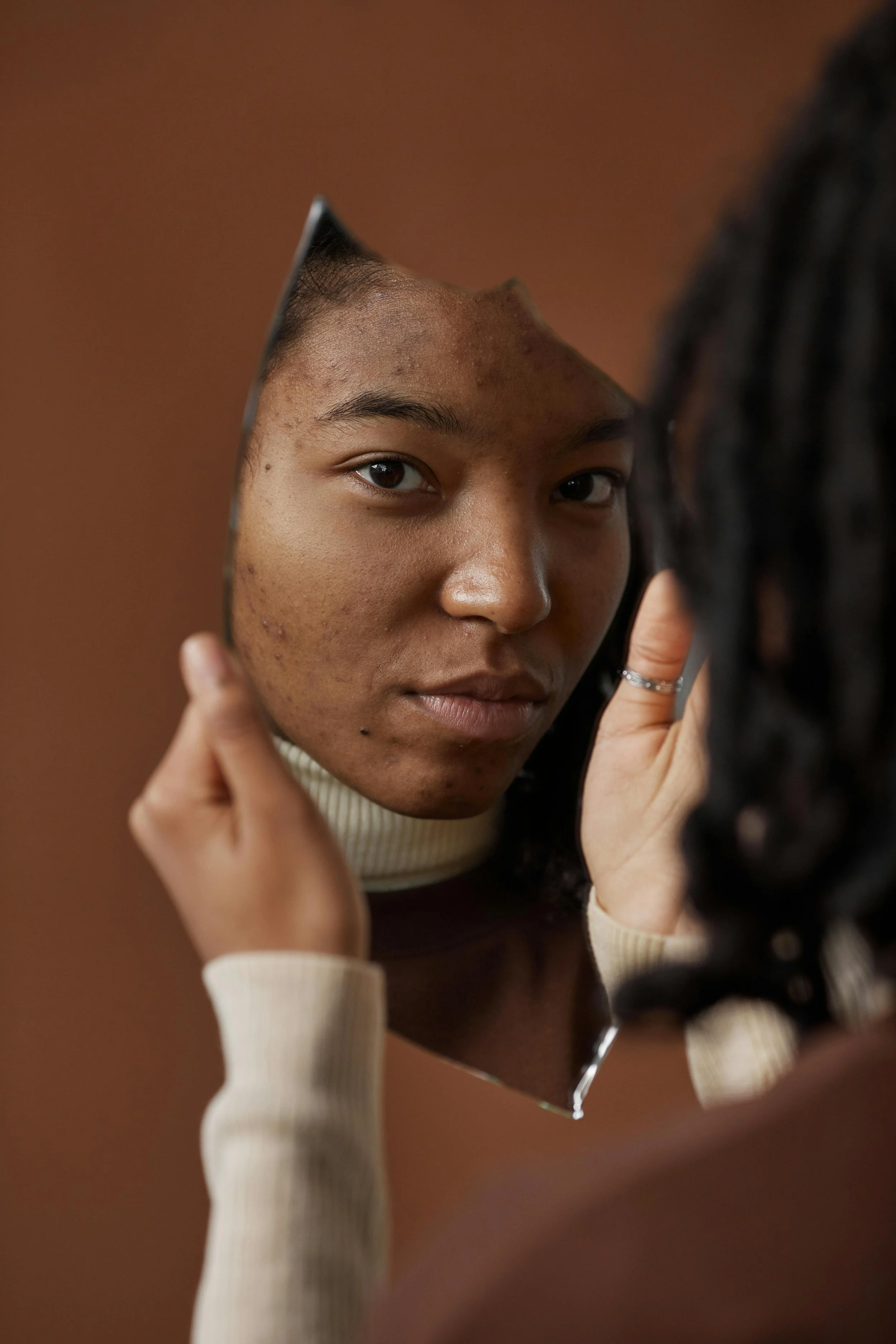 Sensitive &amp; reactive skin: how to calm it, and the gentlest active that helps