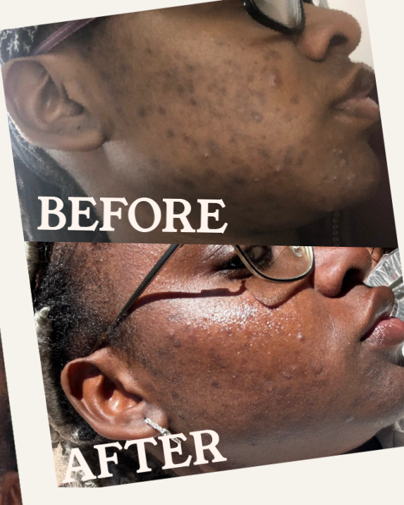 founder+before+and+after.png