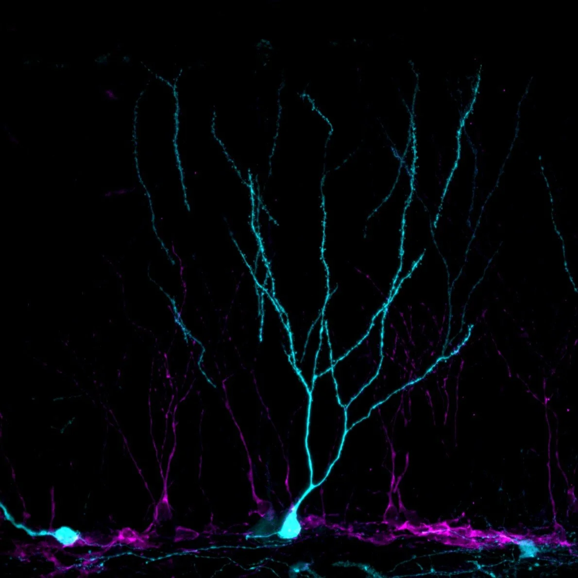 Fotos bien TBI virus_Series001_SubVolume003Snapshot1_ch00.jpeg