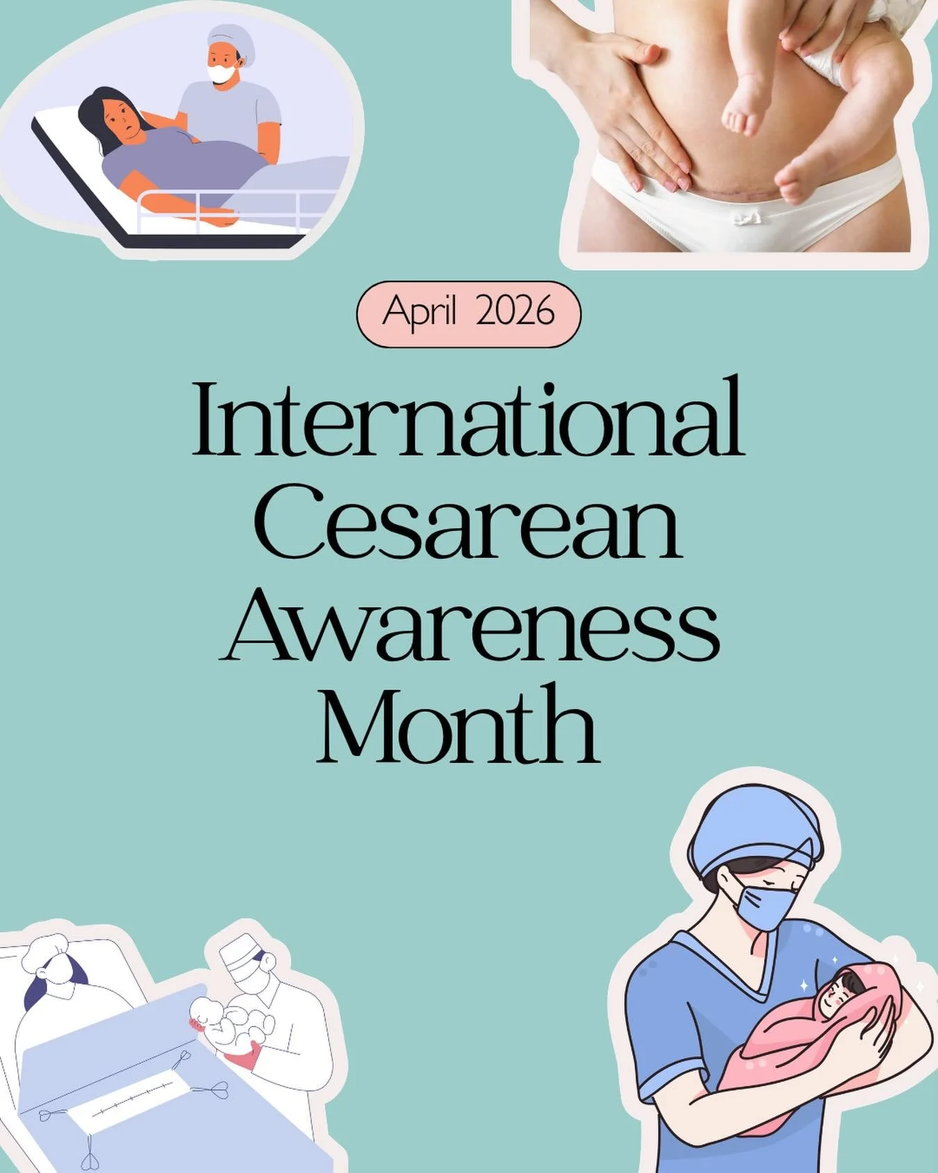 International Cesarean Awareness Month (CAM) takes place in April. It&rsquo;s organised by the International Cesarean Awareness Network (ICAN), a non-profit that aims to improve maternal and child health. The month focuses on topics related to C-sect