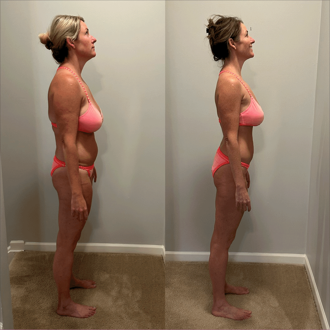 Before & After GLP1 Weight Loss Images